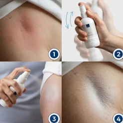 Abena Zink Spray Protetor 100ml | 10% Óxido de Zinco | Barreira Protetora para Pele Sensível