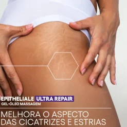 A-Derma Epitheliale A.H Duo Gel-Óleo Massagem 40ml | Cicatrizes e Estrias