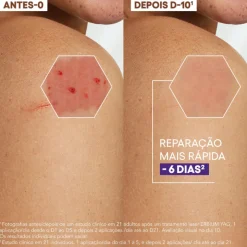 A-Derma Epitheliale A.H Ultra Creme Reparador 40ml | Antimarcas