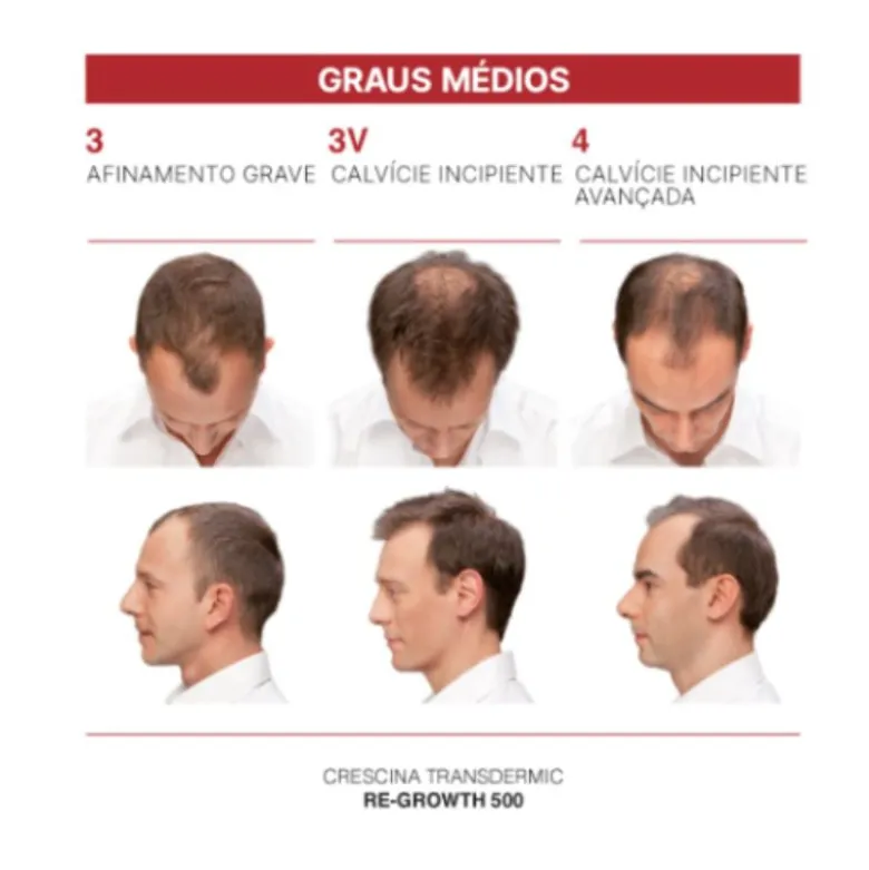 Crescina Transdermic HFSC Tratamento Completo 500 Homem| Ampolas 20x3,5ml + Champô Antiqueda