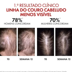 Dercos Aminexil Clinical Sérum Regenerador 90ml | Queda Capilar