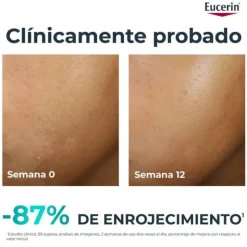 Eucerin DermoPure Hydra Repair 40ml | Creme Reparador para Pele com Acne