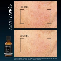 Filorga Daily Peel Antimanchas 50ml Peeling Noturno | Corrige Manchas e Uniformiza o Tom