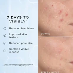 Medik8 Niacinamide Peptides Sérum 30ml | Reduz imperfeições e poros