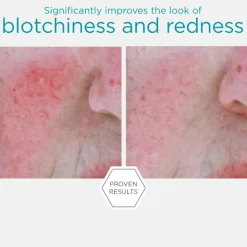 Neostrata Redness Neutralizing Sérum 29g