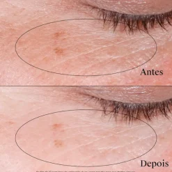 Neutrogena Collagen Bank Gel-Creme Olhos 15g | Olheiras, Inchaço & Linhas Finas