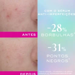 Nuxe Zinc Power Sérum Anti-Imperfeições 30ml