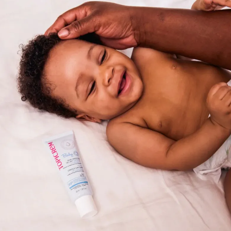 Topicrem BABY Crosta Láctea 40ml | Cuidado Express Suave