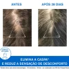 Uriage DS Hair Champô Caspa 500ml | Caspa Seca e Oleosa