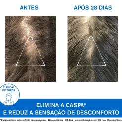 Uriage DS Hair Champô de Tratamento Anticaspa 200ml
